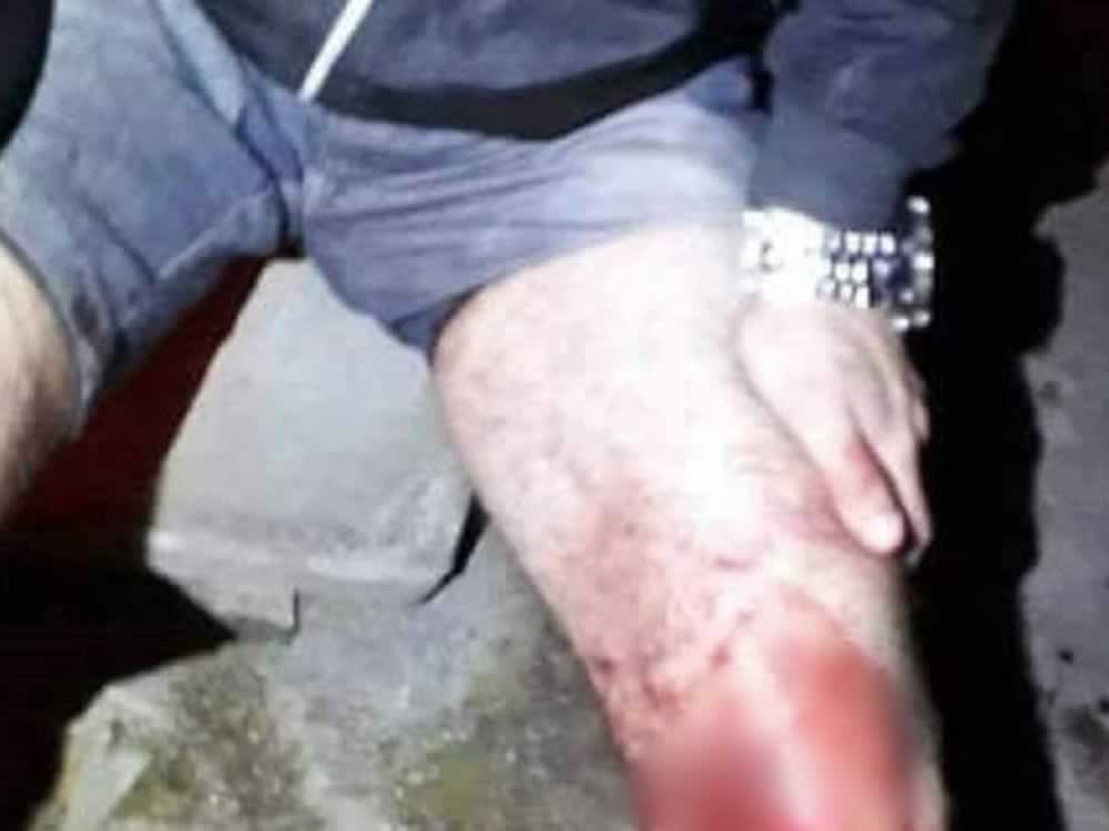 Imagem de Comerciante é baleado na perna durante roubo