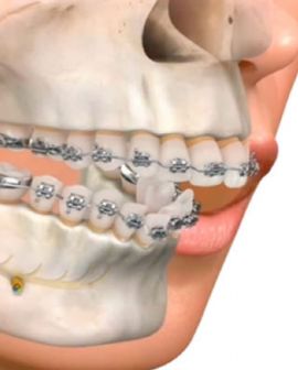 Imagem de HURSO é único Hospital com atendimento de bucomaxilofacial no sudoeste goiano